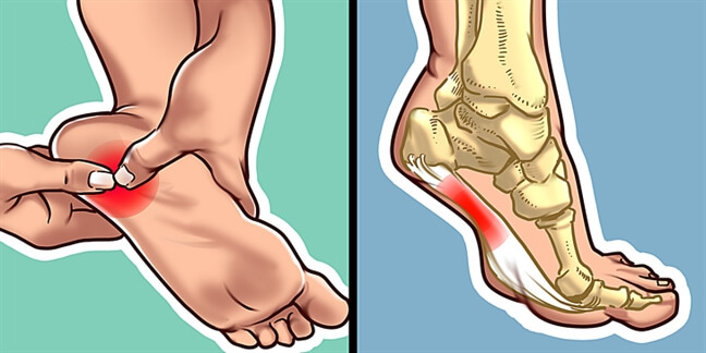 Xoa bóp bấm huyệt trị đau gót chân